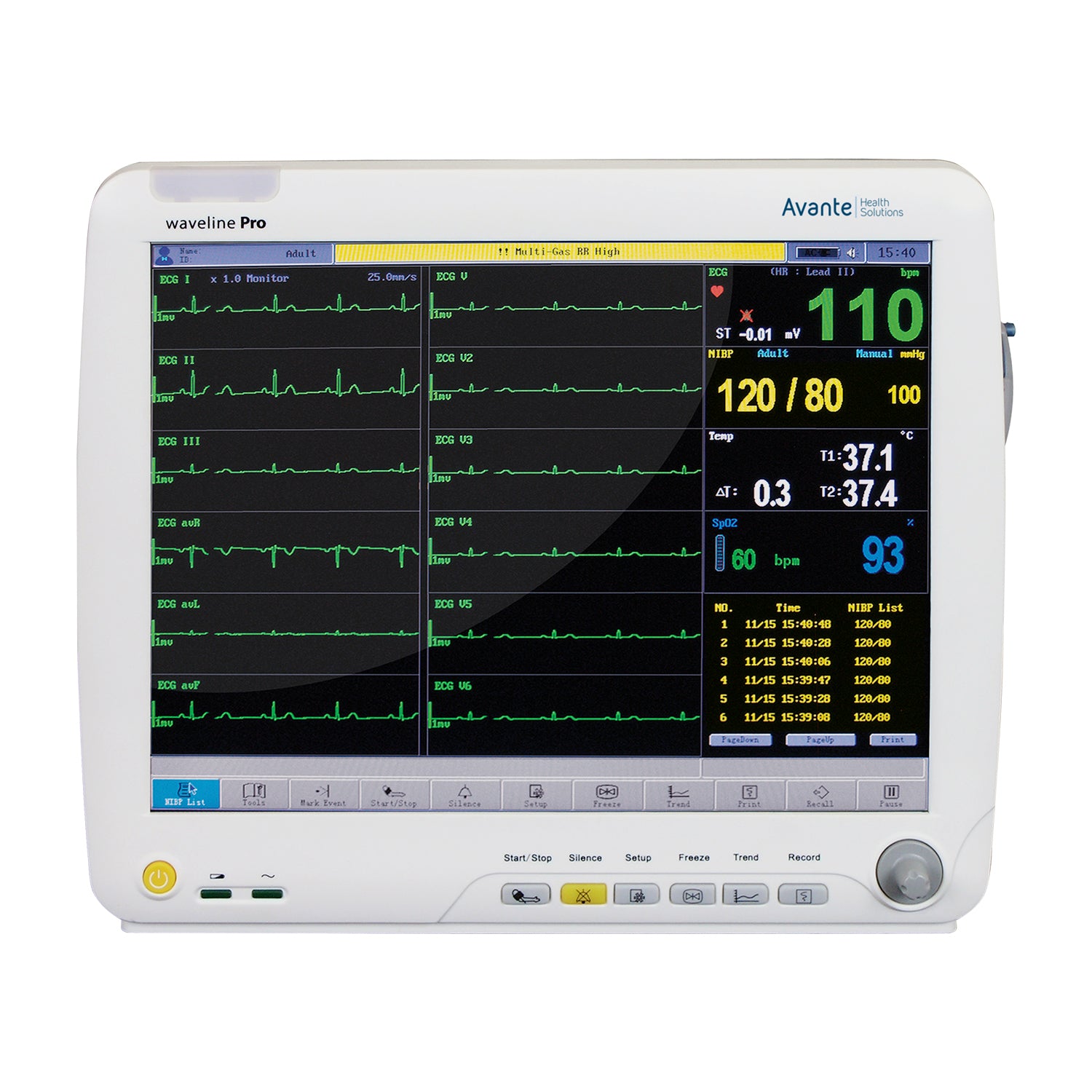 Avante Waveline Pro Touch-Screen Anesthesia Monitor